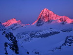 dent_blanche.jpg